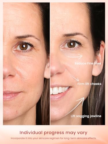 Radio Frequency Skin Tightening Device with 3 Levels L7176