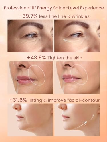 Radio Frequency Skin Tightening Device with 3 Levels L7176